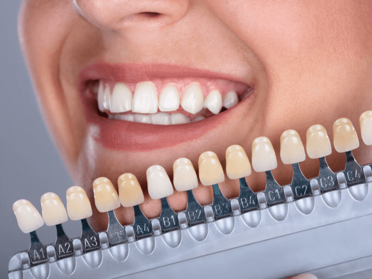 Veneers und Ihr zukünftiges Lächeln
